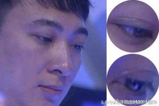 男明星双眼皮贴,揭秘男星双眼皮的秘密